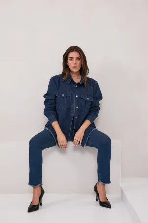 Slim Jeans With Scalopped Edge